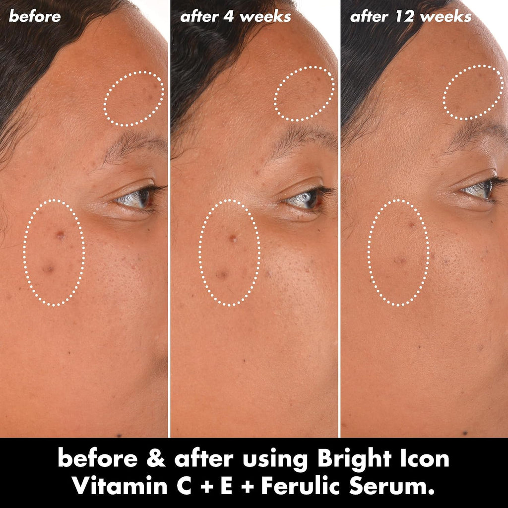 e.l.f. SKIN Bright Icon Vitamin C + E + Ferulic Serum. 1 oz | Brightening Serum with 15% Vitamin C. 1% Vitamin E & 0.5% Ferulic Acid. Helps the Look of Dark Spots. Vegan & Cruelty-Free