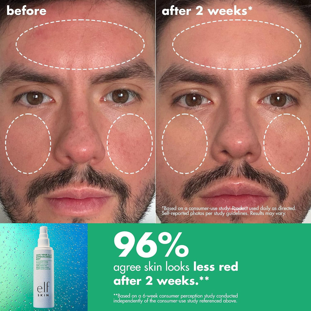e.l.f. SKIN Save Your s.e.l.f. Hypochlorous Mist | Dermatologist-Developed Facial Spray. Soothes & Calms Redness. Sensitive & Blemish-Prone Skin. Vegan & Cruelty-Free