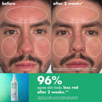 e.l.f. SKIN Save Your s.e.l.f. Hypochlorous Mist | Dermatologist-Developed Facial Spray. Soothes & Calms Redness. Sensitive & Blemish-Prone Skin. Vegan & Cruelty-Free