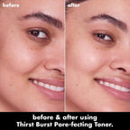 e.l.f. SKIN Thirst Burst Pore-fecting Toner. Hydrating for Face. Smooths. Plumps & Minimizes Pores. Infused with Salicylic Acid. Vegan & Cruelty-Free
