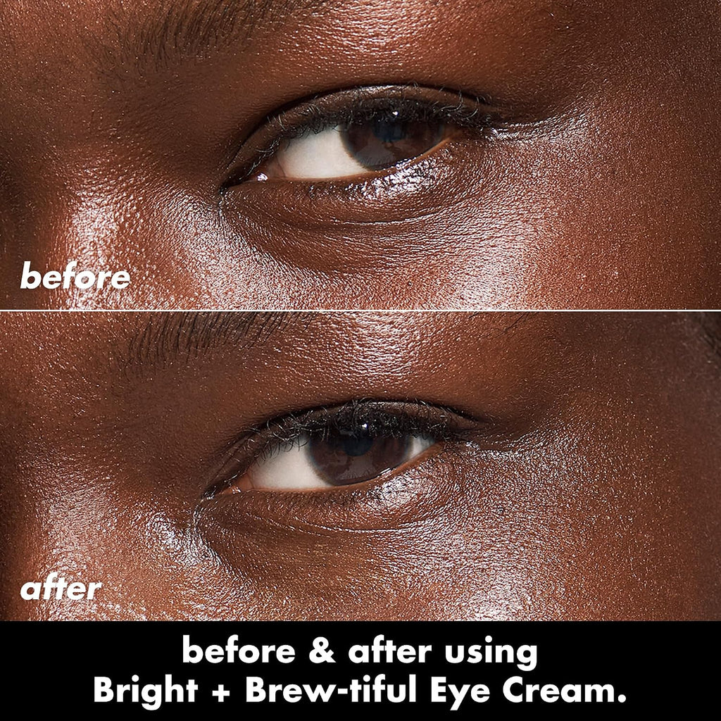 e.l.f. SKIN Bright + Brew-tiful Eye Cream. Helps Brighten Appearance Of Undereye Dark Circles & Repair Puffiness. Vegan & Cruelty-Free